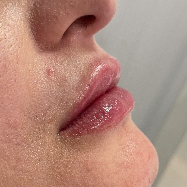 Dra. Susane Paschoal - Dentista Petrópolis, Harmonização Facial, Ortodontia, Clareamento Dental - foto 4