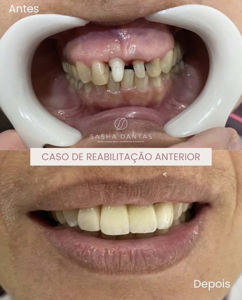 Dra. Sasha Dantas - Dentista - Madureira - foto 4