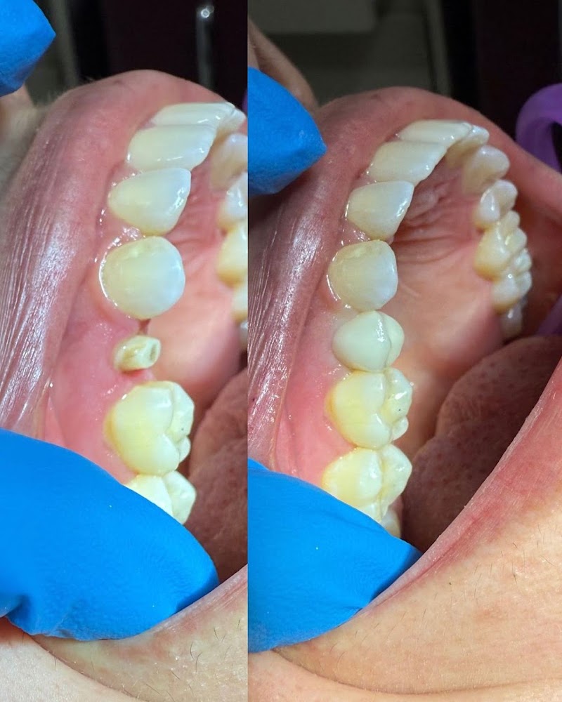 Dra Hianna Corrêa Odontologia Especializada - foto 5