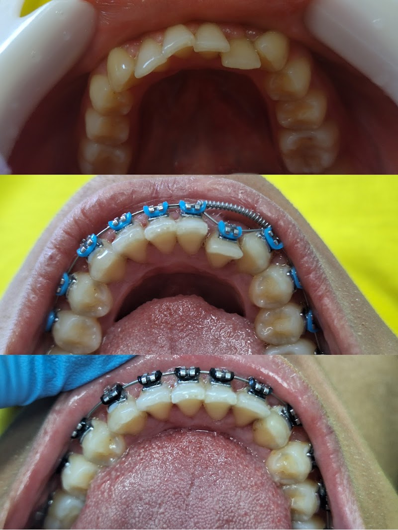 Dra. Melina Cavalcanti - Ortodontia / Alinhadores Invisíveis SouSmile e Harmonização Facial - foto 3
