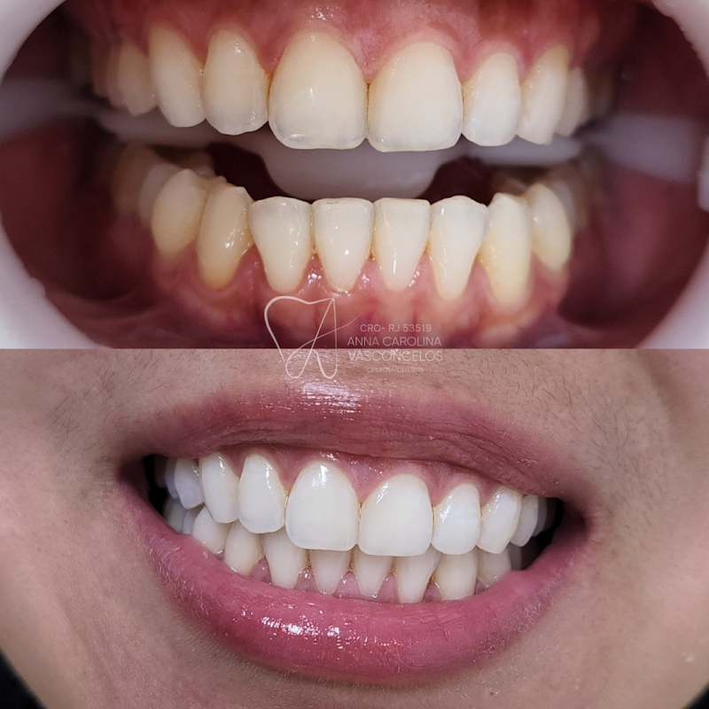 Anna Carolina Vasconcelos - Dentista Endodontia em Copacabana - foto 2