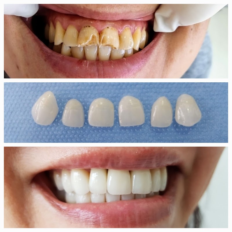 Implantes Dentários e Reabilitação Oral | Sakakura Odontologia Integrada - Bela Vista São Paulo - foto 3