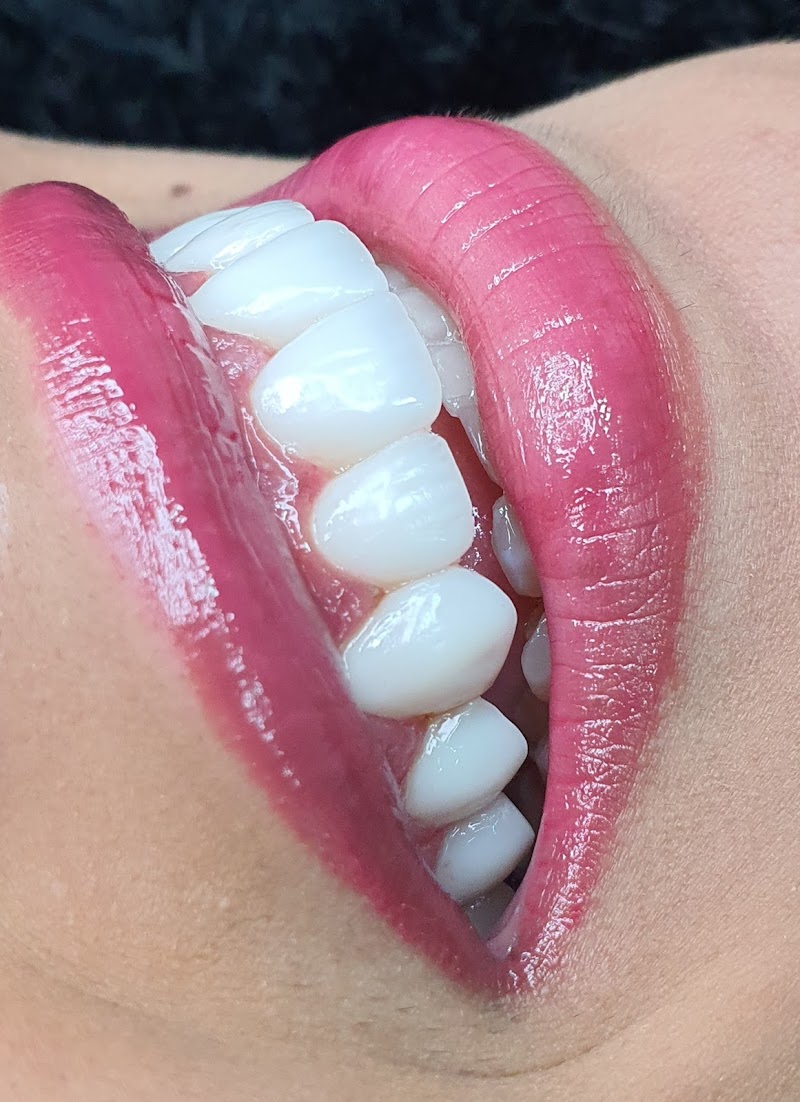 Implantes Dentários e Reabilitação Oral | Sakakura Odontologia Integrada - Bela Vista São Paulo - foto 5