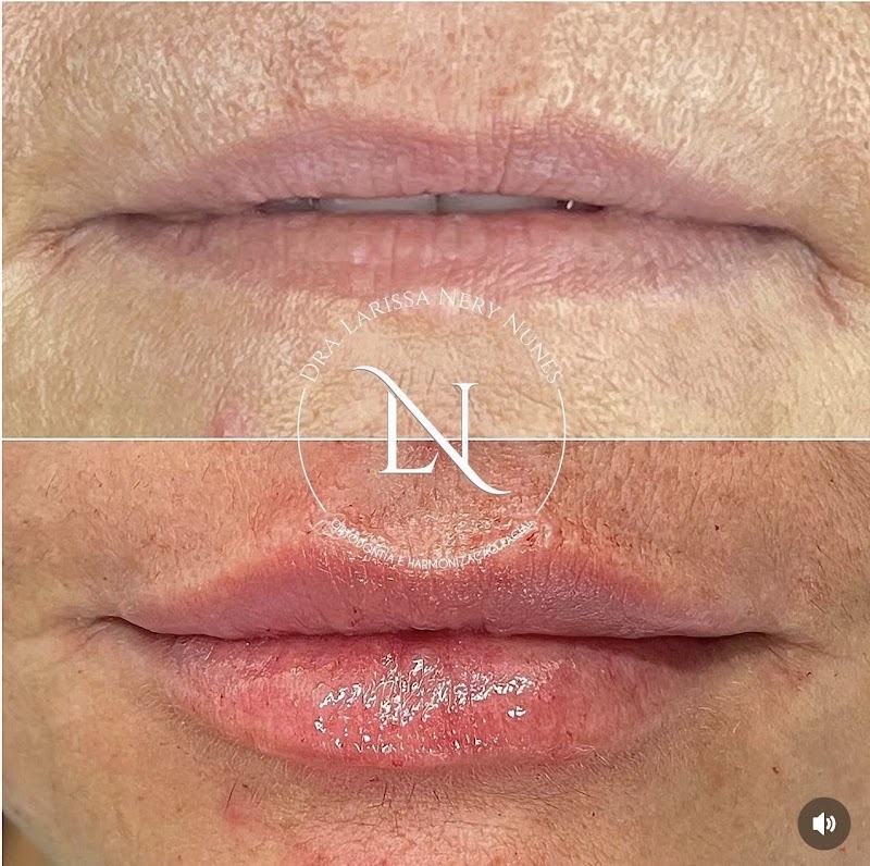 Dra. Larissa Nery Nunes Dentista - foto 1