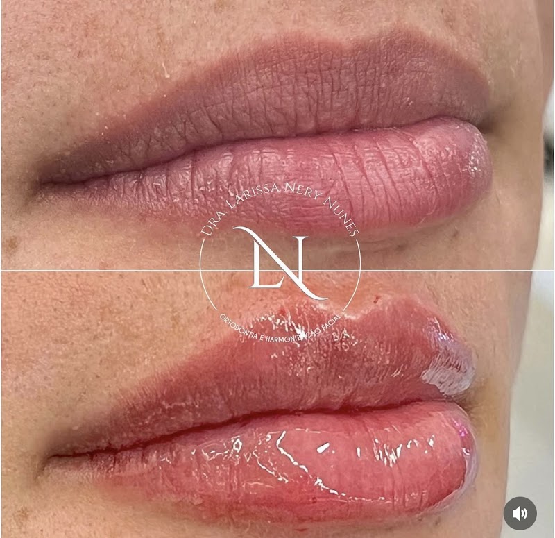 Dra. Larissa Nery Nunes Dentista - foto 4