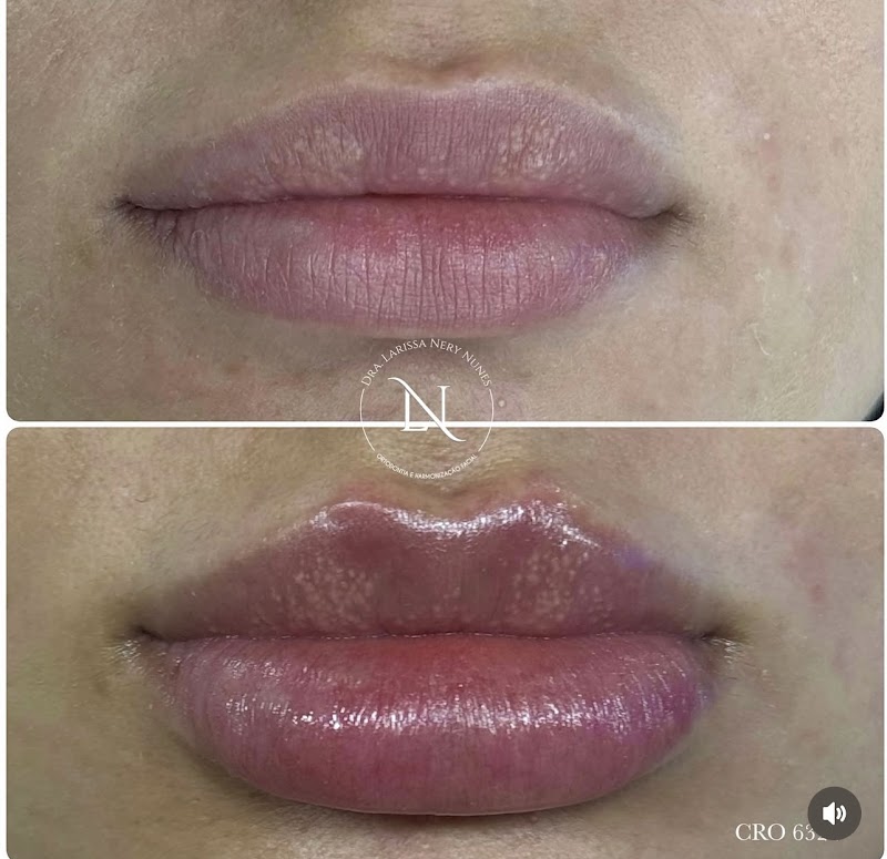 Dra. Larissa Nery Nunes Dentista - foto 5