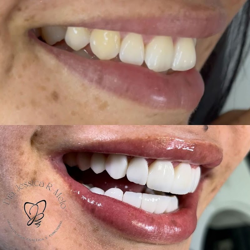 Dra. Jessica R. Melo - Arquiteta de Sorrisos - foto 2