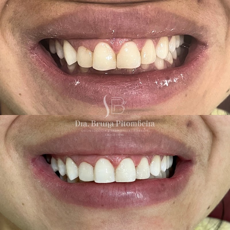 Dra. Bruna Pitombeira - foto 5