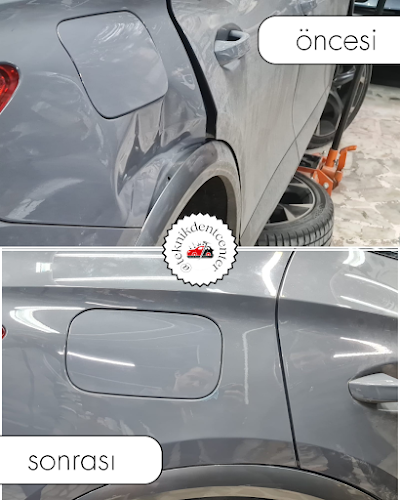 Teknik Dent Center Boyasız Göçük Düzeltme - Oto Servisi