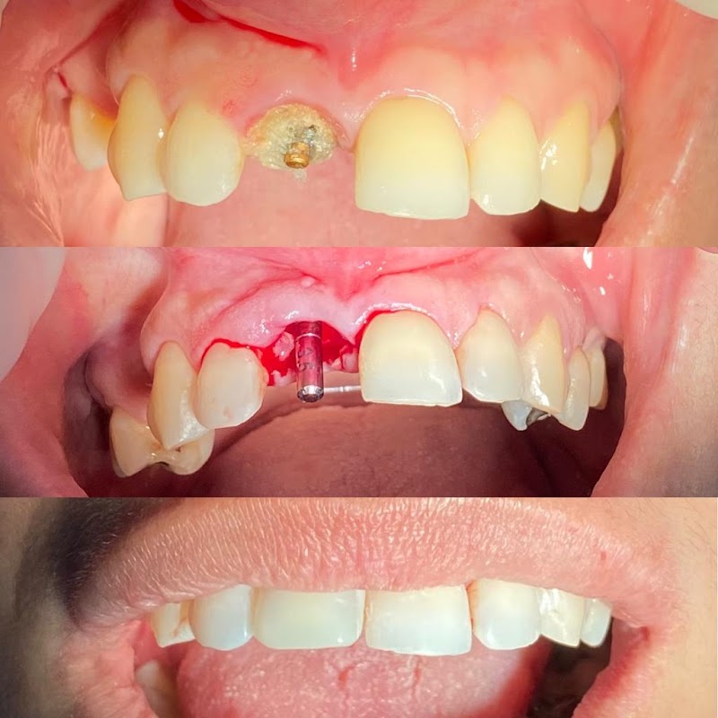 Dr. Bruno Torres - Cirurgia Ortognática & Implantes dentários em Aracaju - foto 2