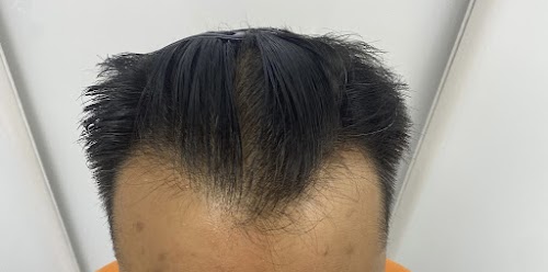 London Hair Transplant Clinic logo