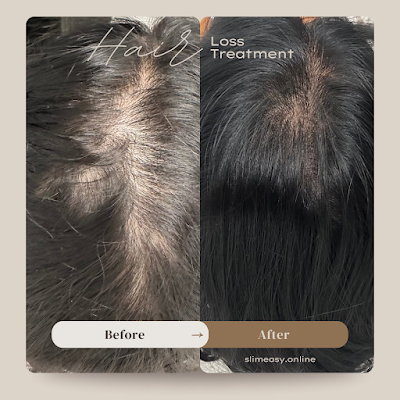 Slim Easy Medical Weightloss & Wellness photo 6