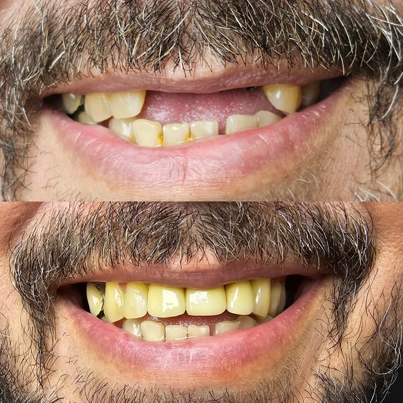 Dr. Thiago Lucena | Bucomaxilofacial | Implante dentário Zigomático | Siso | Estomatologia | Bradesco Saúde | Duque de Caxias