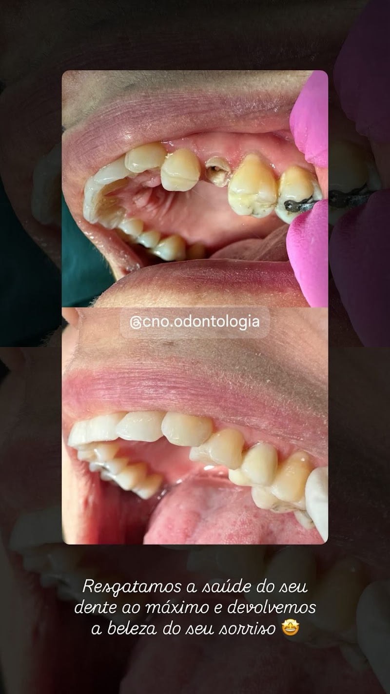 CLINICA NERES ODONTO - C.N.O ODONTOLOGIA - foto 4
