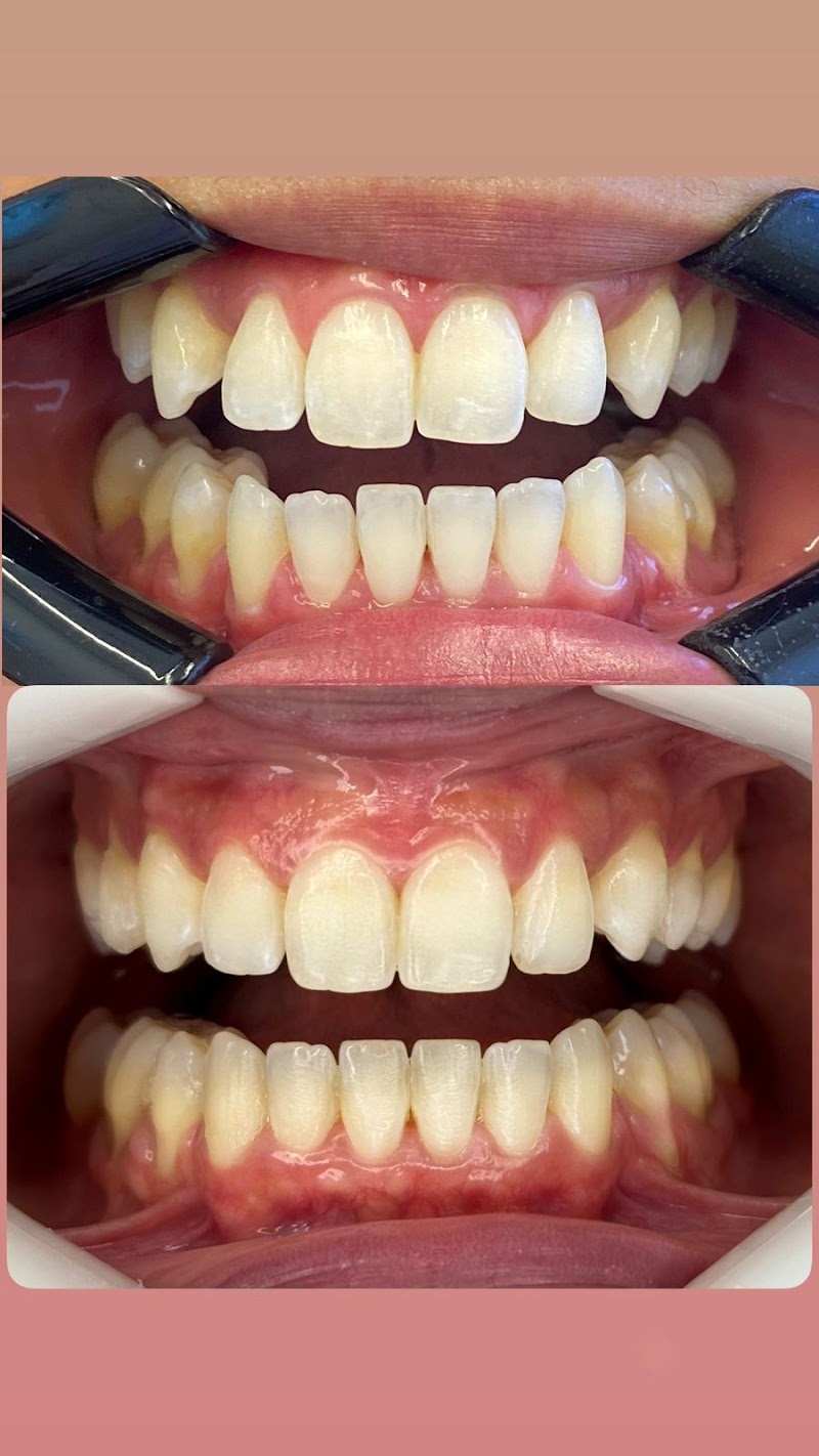 Dra. Manuela Oliveira, Dentista Taquara Rj - Invisalign - Implante Dentário - foto 2
