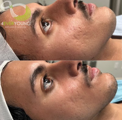 4Ever Young Med Spa & Wellness Center - Philadelphia photo 5