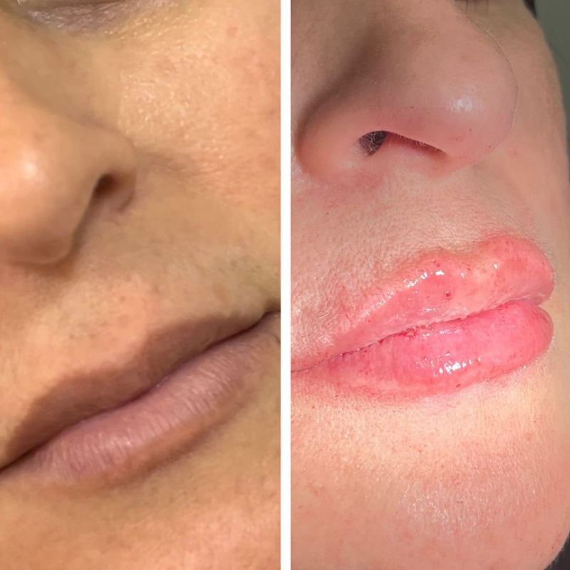 Dentista / Dra. Samantha Koch / Dentista em Campos dos Goytacazes/ Harmonização Facial em Campos dos Goytacazes