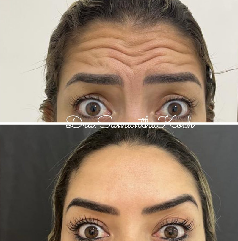 Dentista / Dra. Samantha Koch / Dentista em Campos dos Goytacazes/ Harmonização Facial em Campos dos Goytacazes - foto 4