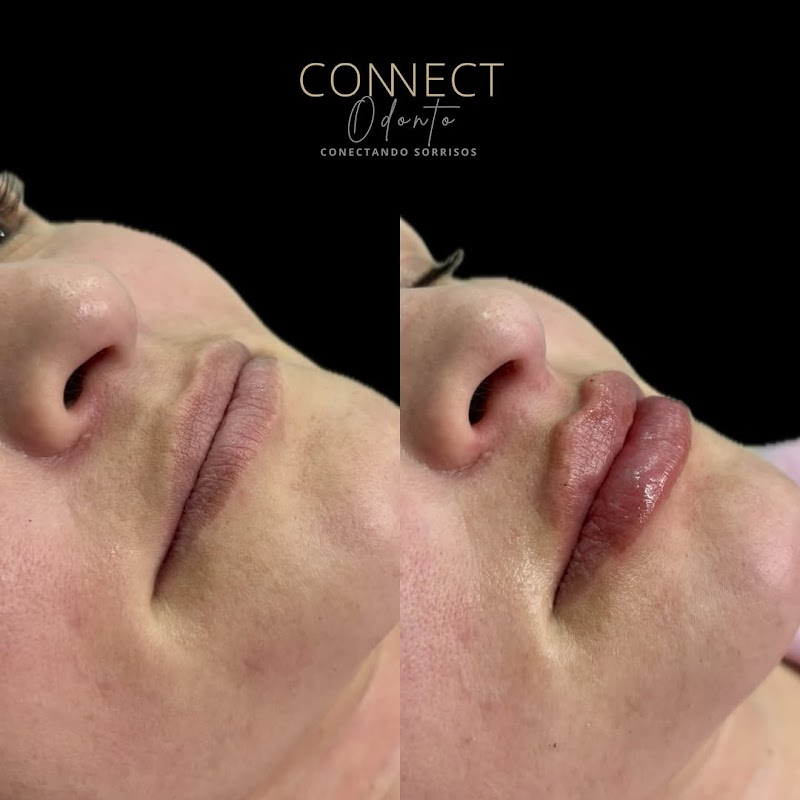 ConnectOdonto Curitiba | Implante Dentário | Dentista em Curitiba PR | Clínica Odontológica - foto 5