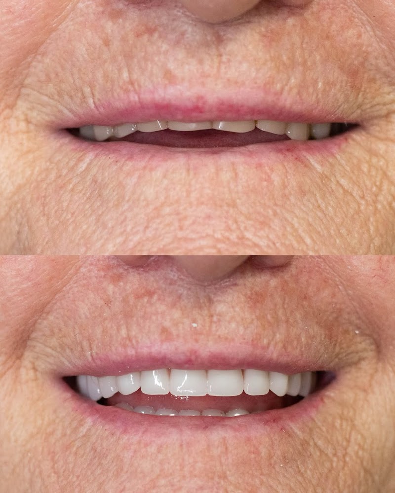 ConnectOdonto Curitiba | Implante Dentário | Dentista em Curitiba PR | Clínica Odontológica - foto 3