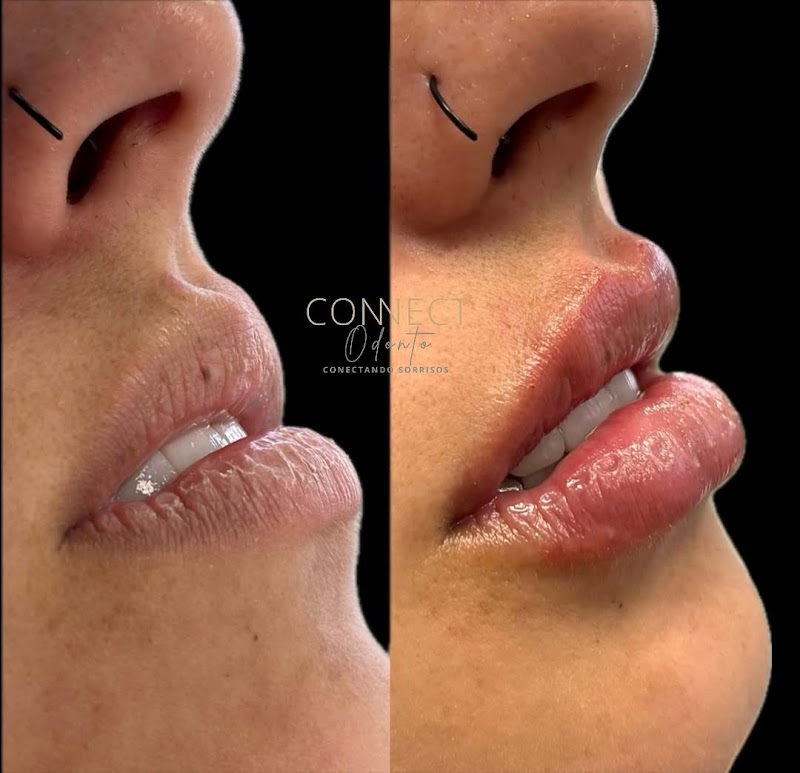 ConnectOdonto Curitiba | Implante Dentário | Dentista em Curitiba PR | Clínica Odontológica - foto 4