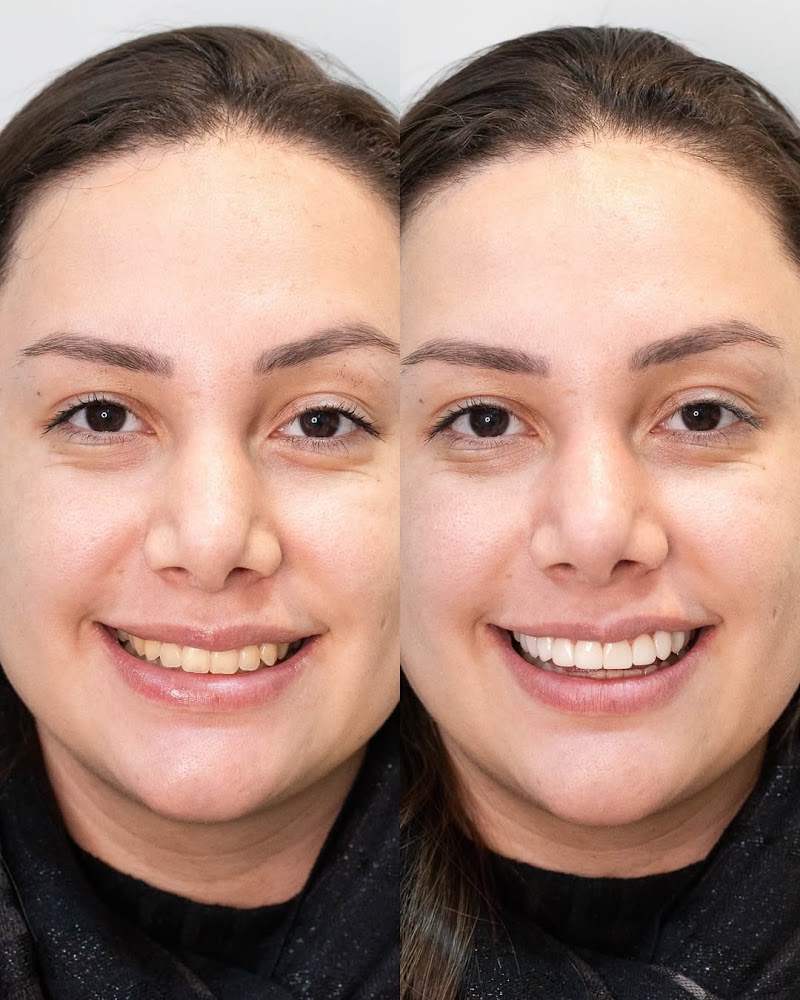 ConnectOdonto Curitiba | Implante Dentário | Dentista em Curitiba PR | Clínica Odontológica - foto 2
