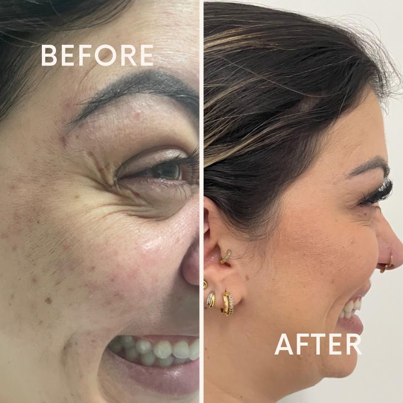 Dentista Odontomix Paraíso - Odontopediatria, Tratamento de Canal, Clareamento Dental, Implante Dentário, Aparelho Invisível - foto 5