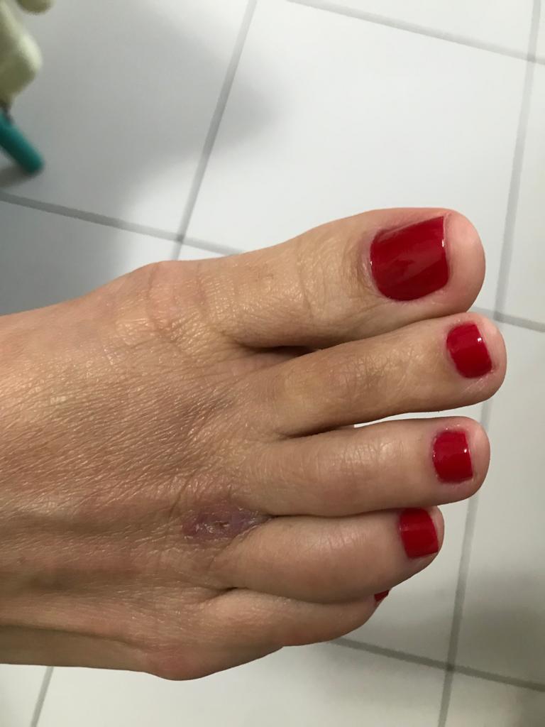 Foto de Dr. Allex Argente Caetano | Ortopedista Especialista em Pé e Tornozelo