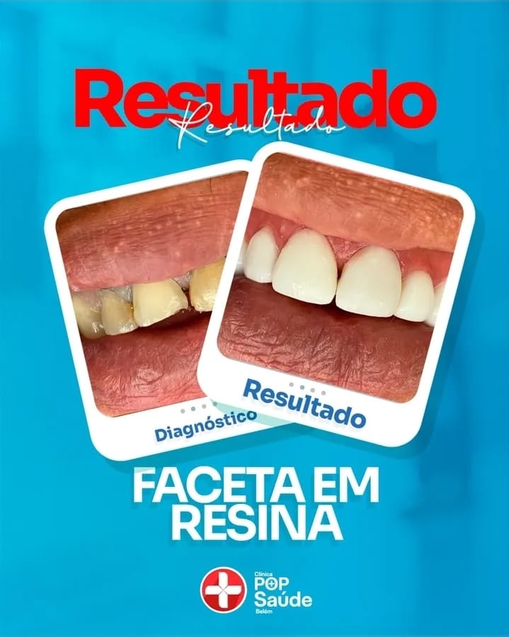 Clínica Odontológica - Pop Saúde - foto 4