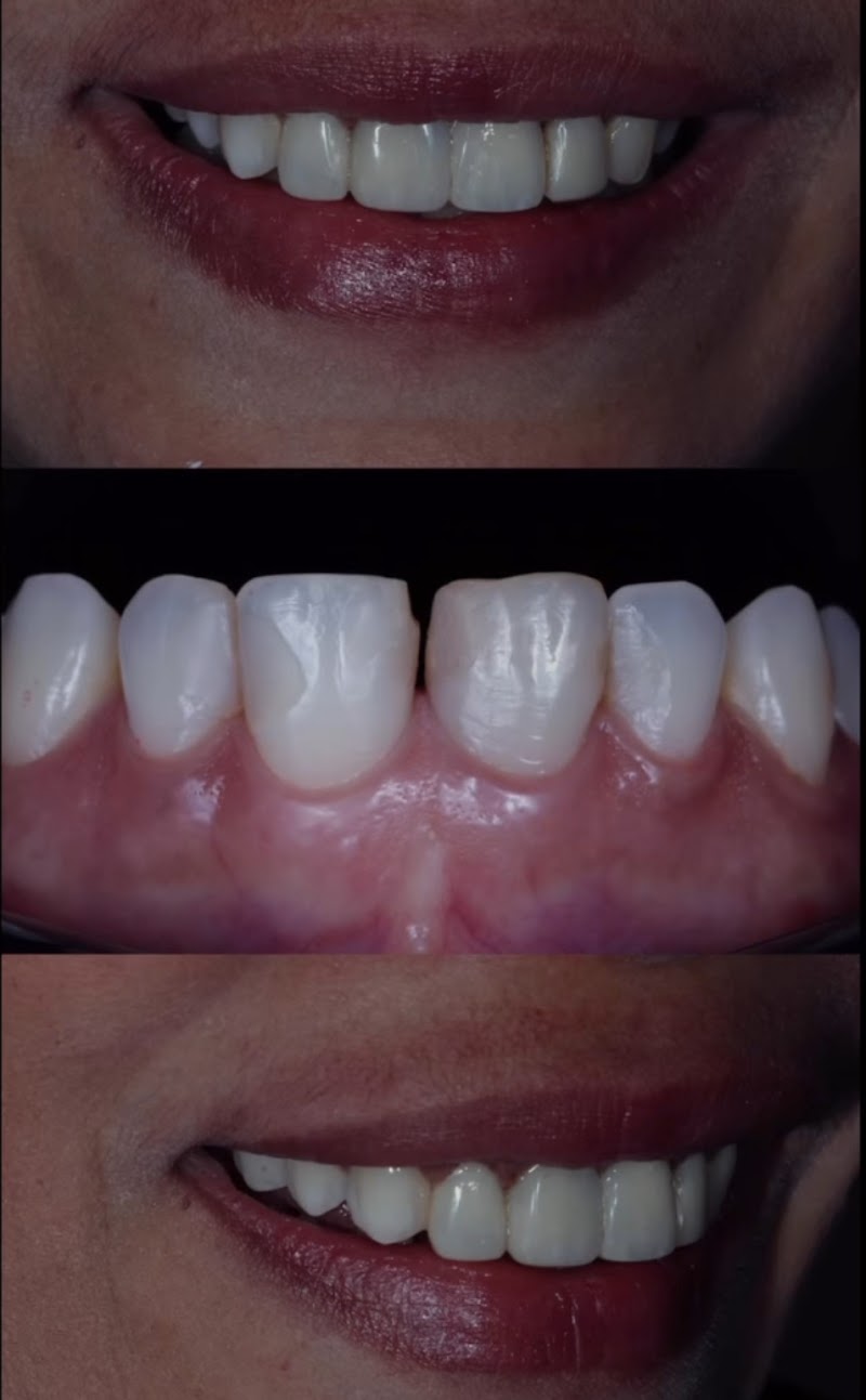 Clínica Orthocenter - Facetas e Harmonização Facial - foto 3