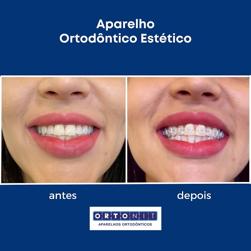 Ortonit São Gonçalo / Clínica Odontológica / Dentista / Ortodontia - foto 5