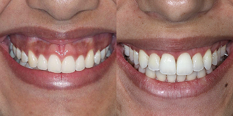 Dentista Curitiba | Clínica Odontológica | NEO SORRISO - foto 5
