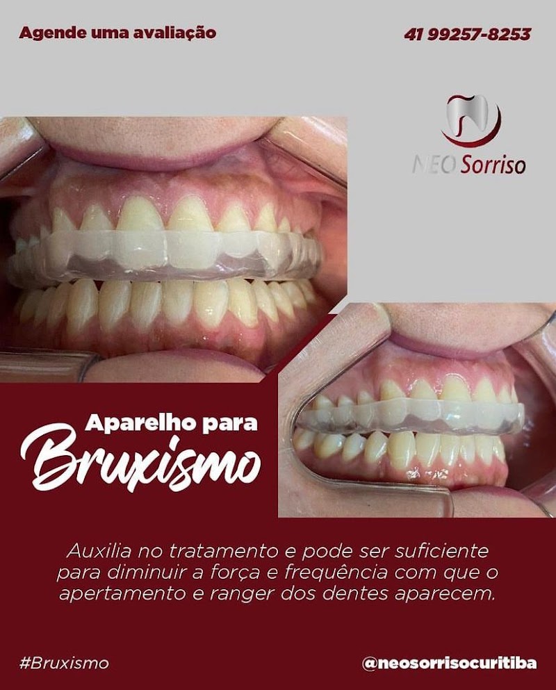 Dentista Curitiba | Clínica Odontológica | NEO SORRISO - foto 3