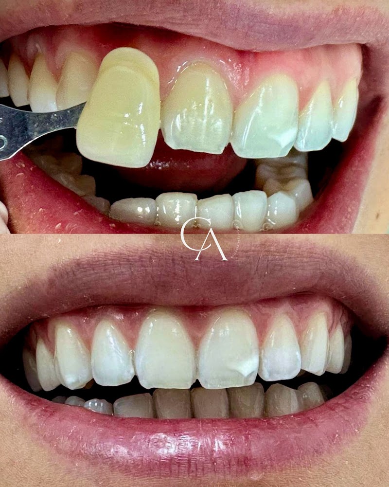 Dra.Cristiane Angélico | Dentista em Moema | Especialista em Aparelhos Invisíveis - foto 4