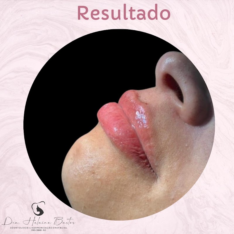 Dra. Helaine Bastos Clínica Estética/Harmonização Orofacial - foto 4