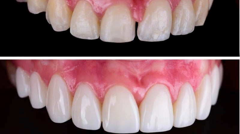Odonto QualityBH - Credenciado Sulamérica Odonto, Odontoprev, Bradesco Dental e Exames Periódicos Petrobras