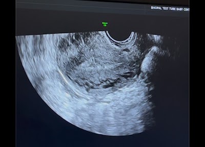 Dr Monica Singh: Best Top Skill Gynaecologist sonologist Laparoscopic Surgeon Obstetrician IVF Specialist Bhopal; 9200002833 - Image 2