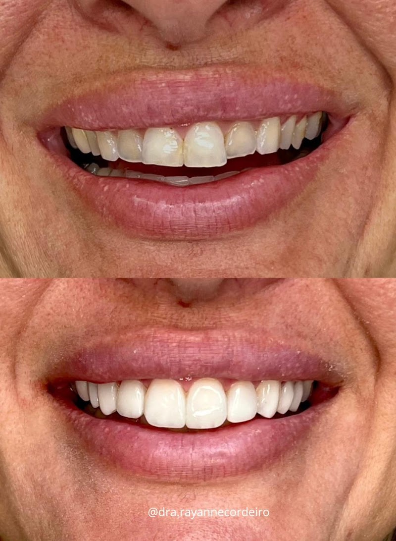 INOA Odontologia | Dentista em Maceió - foto 1