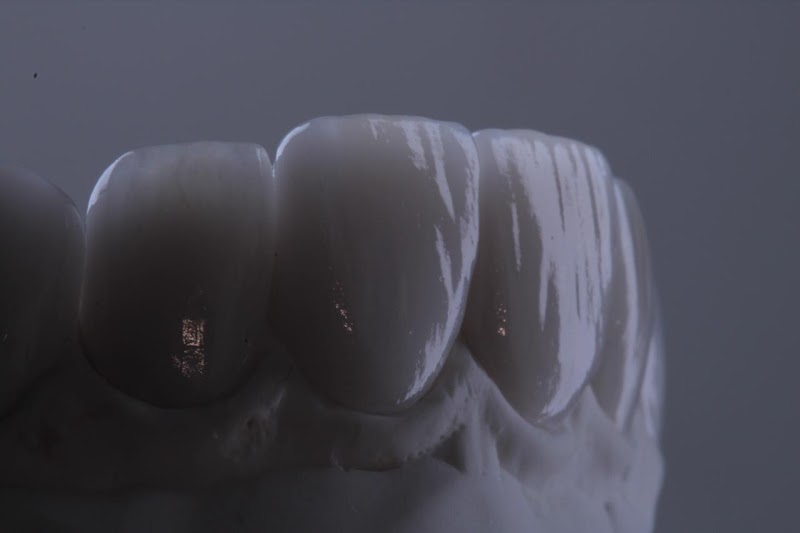 Humanize Odonto l Dra Jully Lobo - Dentista - implantes - lentes - protese dental - botox - ortodontia - canal - foto 5