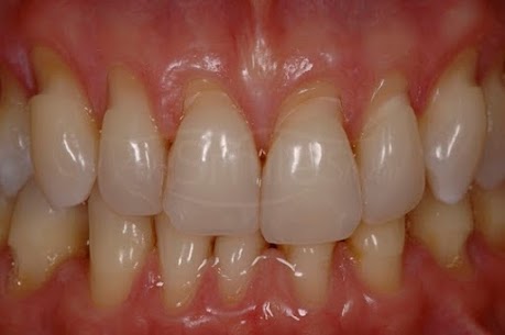 Dr. Daniel Freire Dentista José Walter: Periodontia, Implantes, Prótese em Fortaleza CE - foto 4