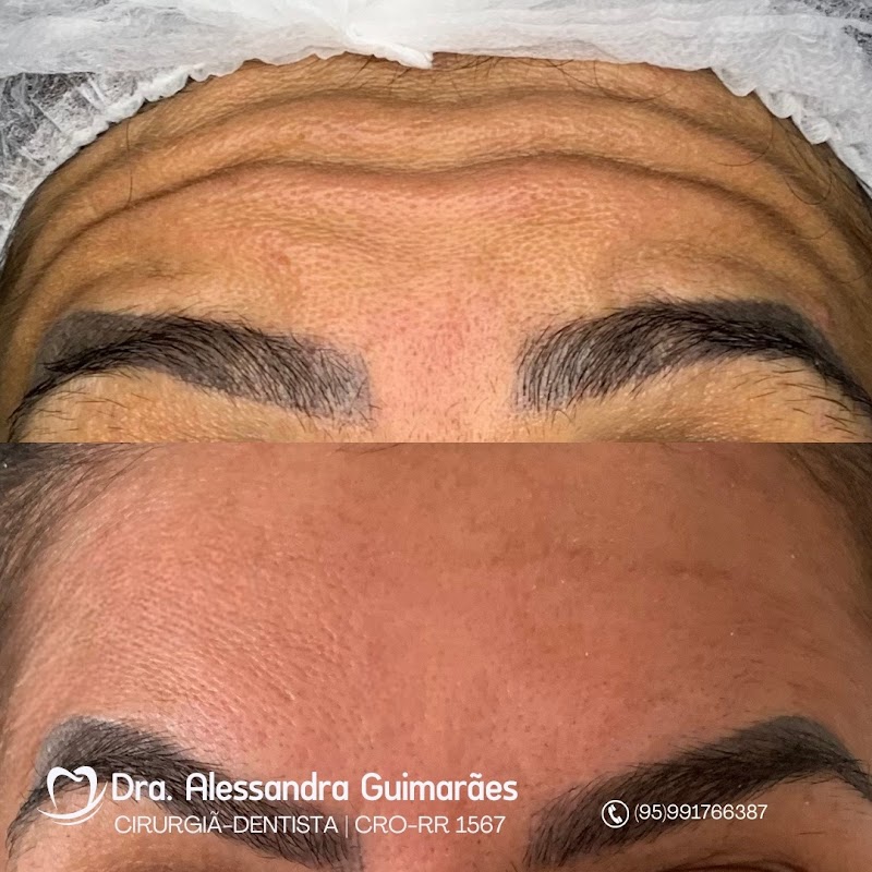 Dra. Alessandra Guimarães - Tratamento de Canal - foto 5