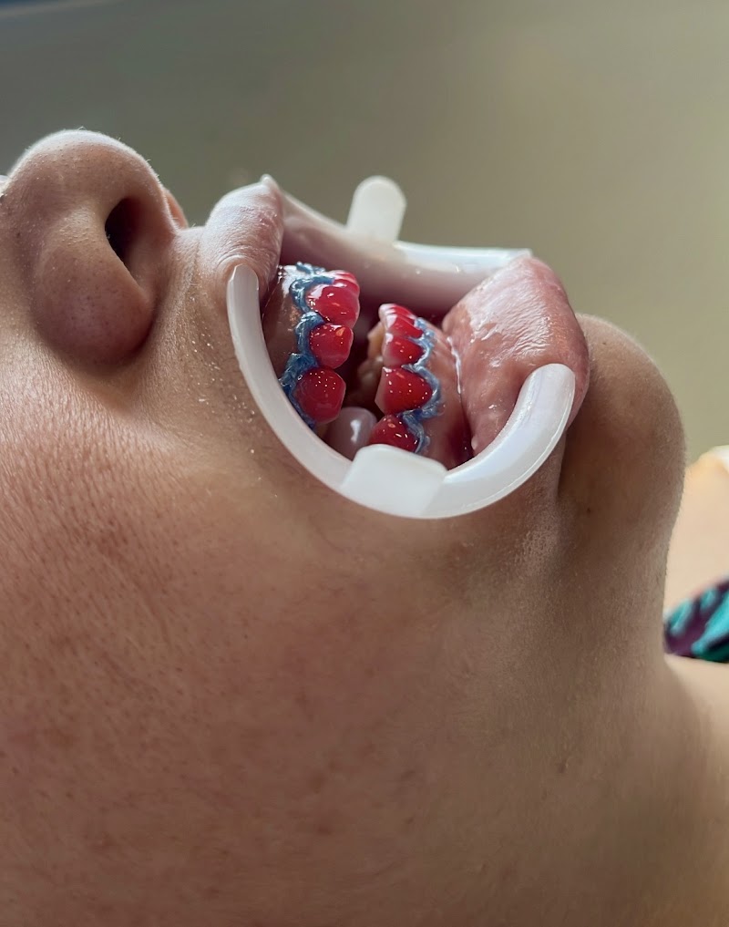 Dra. Alessandra Guimarães - Tratamento de Canal - foto 2