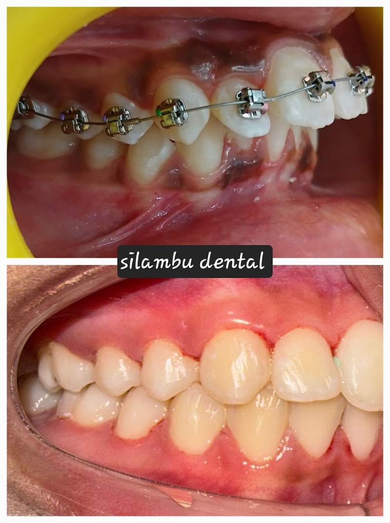 Silambu Dental Clinic