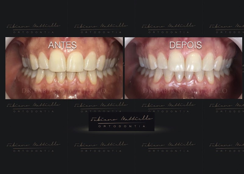 Dr. Fabiano Mattiello | Mont'Serrat - Porto Alegre - RS | Especialista em aparelho ortodôntico - foto 4