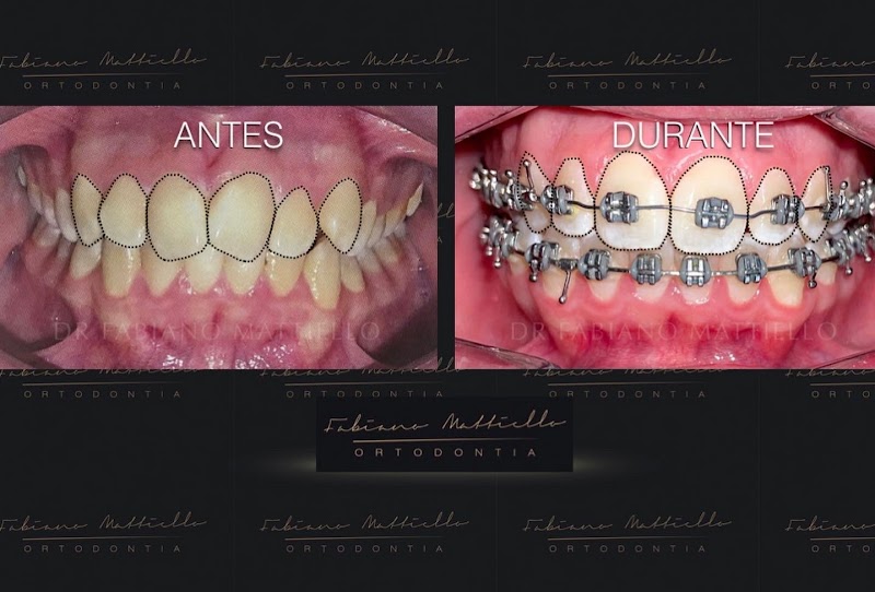 Dr. Fabiano Mattiello | Mont'Serrat - Porto Alegre - RS | Especialista em aparelho ortodôntico - foto 3