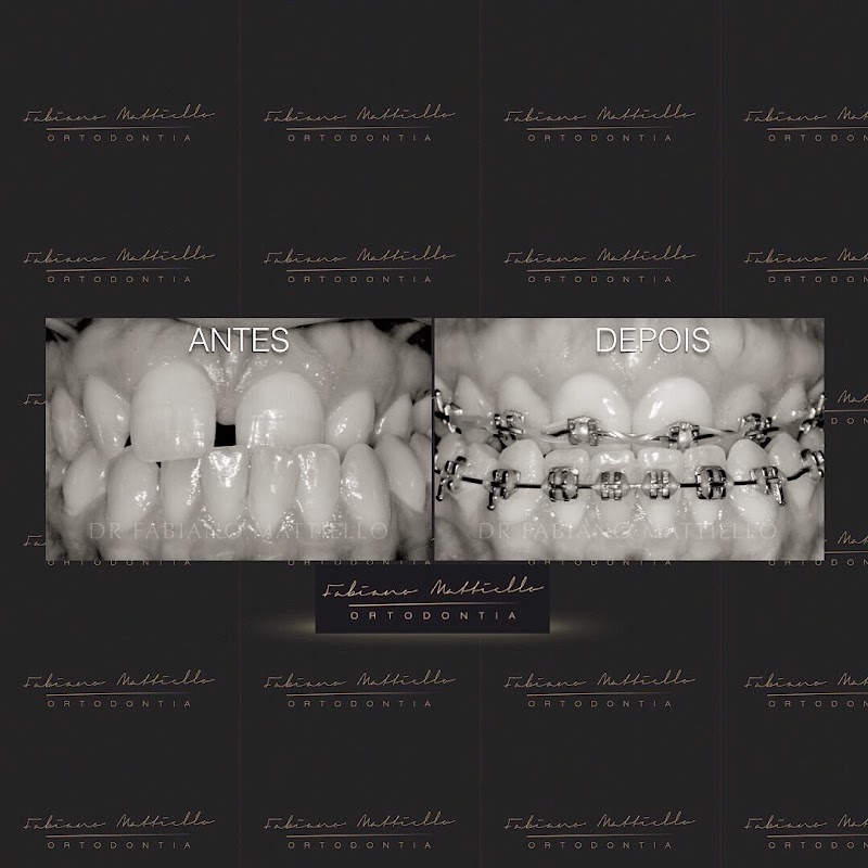 Dr. Fabiano Mattiello | Mont'Serrat - Porto Alegre - RS | Especialista em aparelho ortodôntico