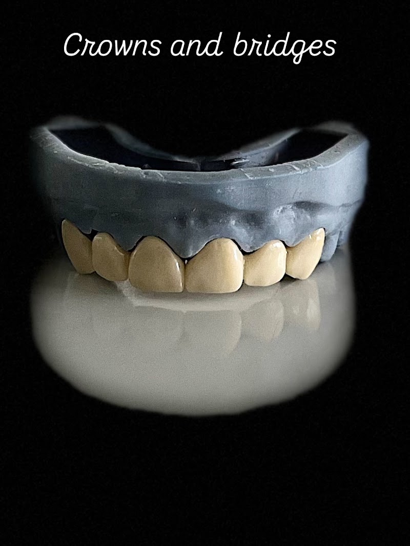 Dentaire Jaipur-Best Dental clinic in Mansarover l Root Canal Treatment in Mansarover clinic