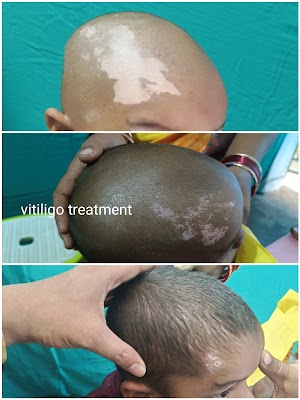 Dr Rakesh kumar patel - Image 2
