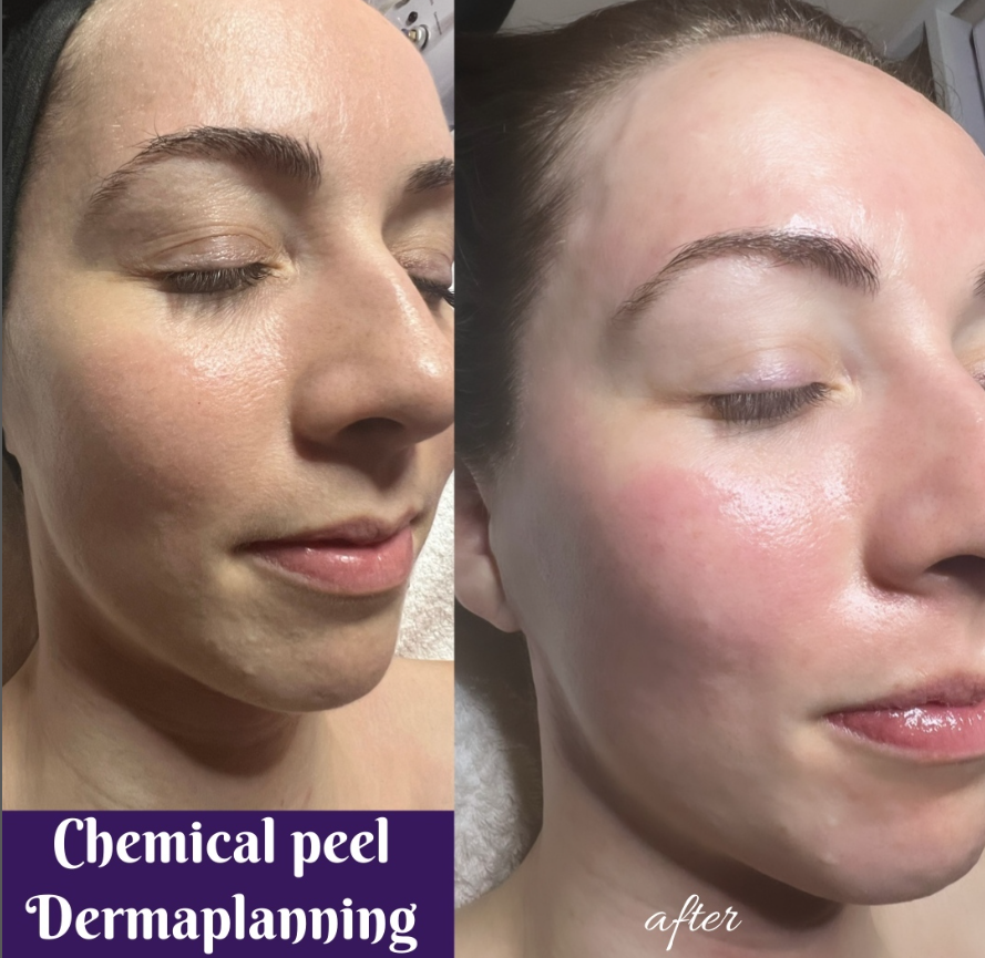ILUMA MEDI SPA in 388 Browns Line, Etobicoke, ON M8W 3T8, Canada