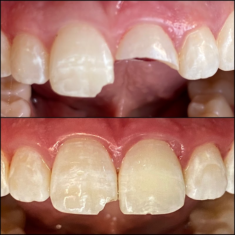 Endodôntica Luiz Clauner - Tratamento de Canal - foto 5